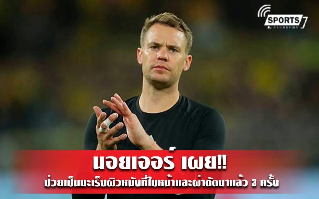 นอยเออร์ เผยป่วยเป็นมะเร็งผิวหนังที่ใบหน้าและผ่าตัดมาแล้ว 3 ครั้ง